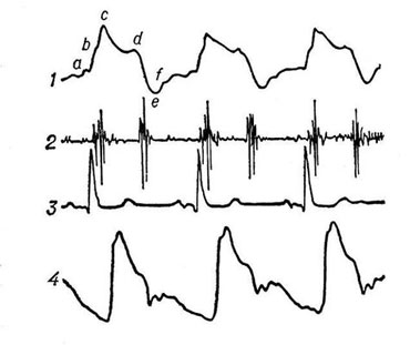 У Закарпатському кардіодиспансері своїх пацієнтів впізнають за кардіограмами