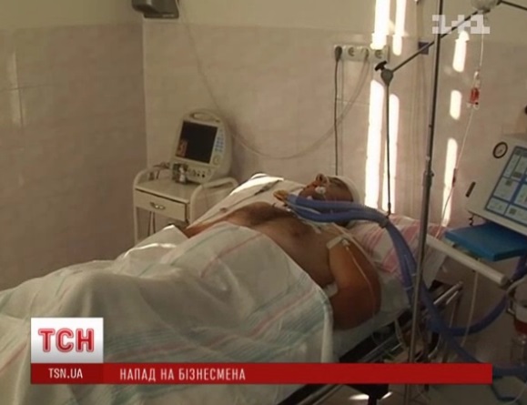 Підприємець, якого жорстоко побили в Мукачеві, все ще в реанімації (ВІДЕО)