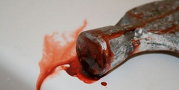 У Липчі на Хустщині жінка у запалі сварки вбила чоловіка молотком