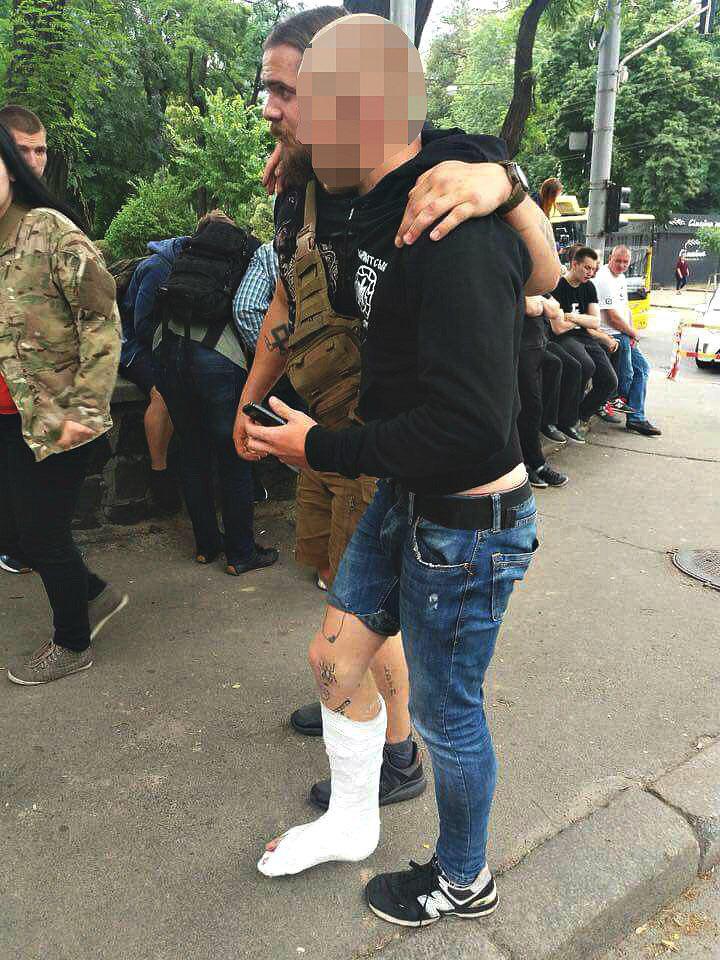 У зіткненнях під час "КиївПрайду" затримали 6-х закарпатців з "Карпатської Січі" (ФОТО)