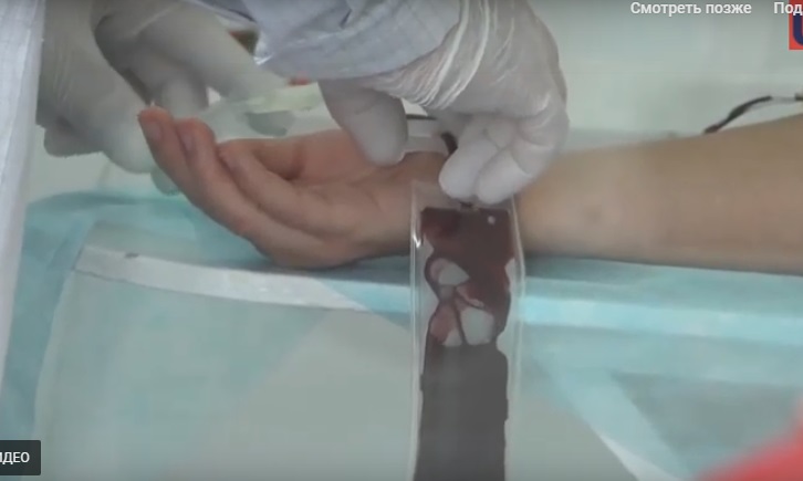 На Закарпатській станції переливання крові критично бракує крові (ВІДЕО)