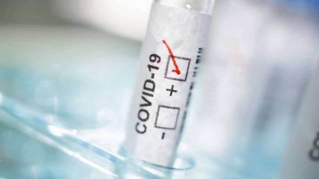 В Ужгороді за добу виявлено 26 нових випадків коронавірусної інфекції, одна людина померла