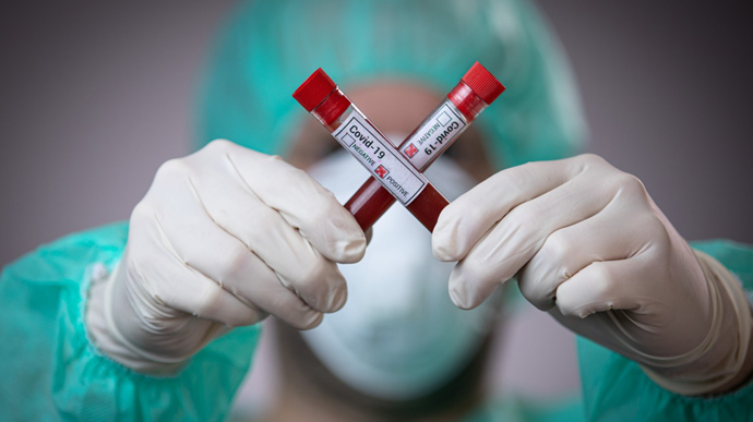 ​4 нові випадки коронавірусної інфекції виявлено за минулу добу в Ужгороді