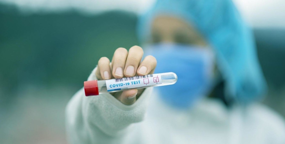 9 нових випадків коронавірусної інфекції виявлено за минулу добу в Ужгороді