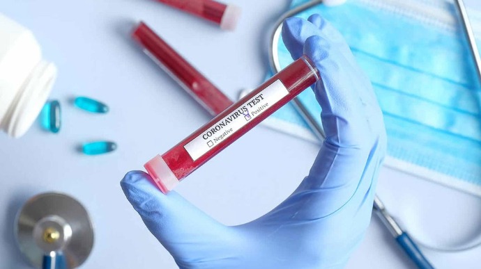 5 нових випадків коронавірусної інфекції виявлено в Ужгороді за минулу добу, 1 людина померла