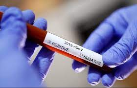 За минулу добу в Ужгороді виявлено 58 нових випадків коронавірусної інфекції, 3 людей померли