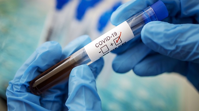 За минулу добу в Ужгороді не виявлено випадки коронавірусної інфекції