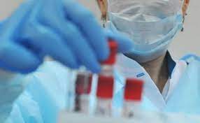 За минулу добу в Ужгороді виявлено 4 випадки коронавірусної інфекції, 1 людина померла
