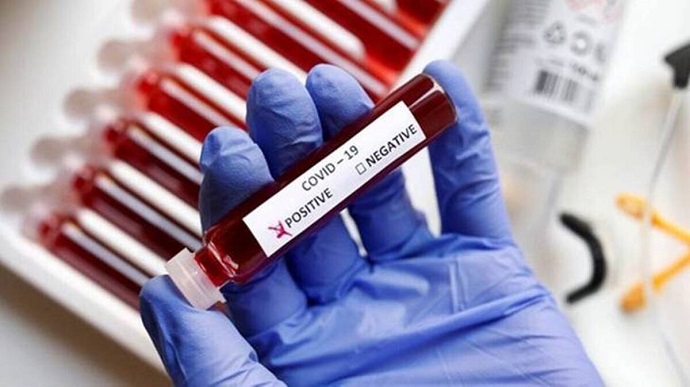 За минулу добу в Ужгороді нових випадків коронавірусної інфекції не виявлено