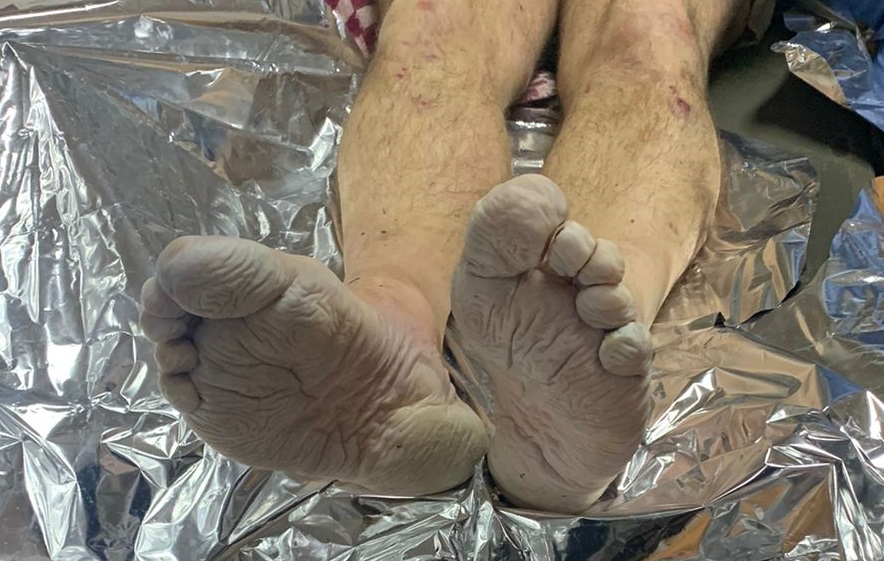 На Рахівщині прикордонники виявили непритомним знесиленого дніпропетровця з обмороженими ногами (ФОТО)