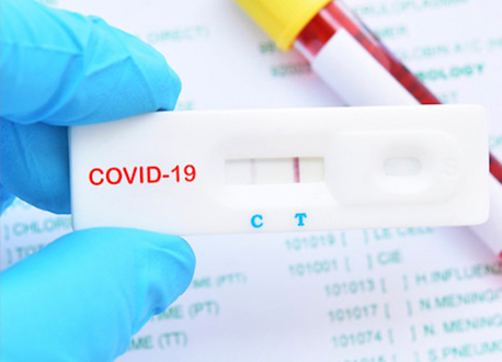 На Закарпаття доставлено понад 9,1 тисяч антиген-тестів для визначення COVID-19