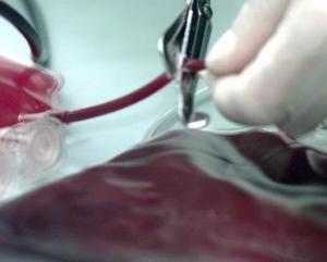 У Канаді вчені навчилися робити кров зі шкіри