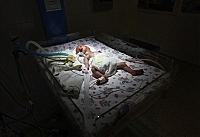 Додаткові дослідження по факту смерті дитини в пологовому будинку Ужгорода проводять львівські судмедексперти (ВІДЕО)