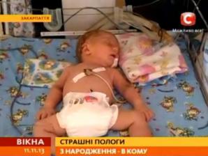 В Ужгородському "роддомі" померло немовля, що місяць перебувало в комі (ВІДЕО)
