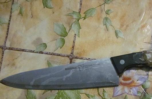 На Тячівщині дружина вдарила чоловіка кухонним ножем (ФОТО)