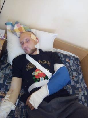 Важко поранений під Чорнухіним закарпатець з Великоберезнянщини потребує допомоги у лікуванні (ФОТО) (ОНОВЛЕНО)