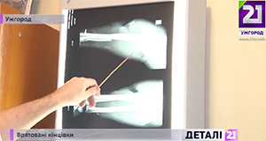 В обласній лікарні в Ужгороді щороку проводять близько 6 операцій із порятунку відірваних кінцівок (ВІДЕО)