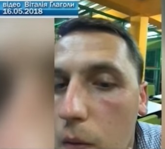 В Ужгороді затверджено підозру нападнику на медійника