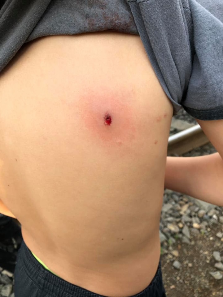 У Хусті невідомий підстрелив хлопчика і стріляв по дітях (ФОТО)