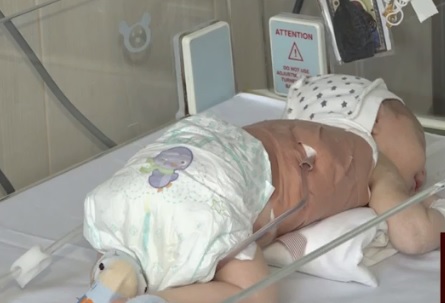 Закарпатська обласна дитяча лікарня отримає нове обладнання для недоношених малюків (ВІДЕО)