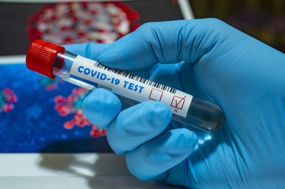 За добу в Ужгороді виявлено 46 нових випадків коронавірусної інфекції, одна людина померла