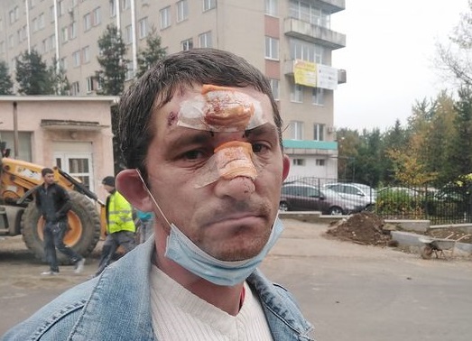 В Ужгороді водій невідомого авто травмував двох пішоходів і втік (ФОТО)