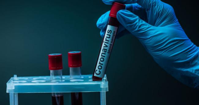 За добу в Ужгороді виявлено 21 новий випадок коронавірусної інфекції