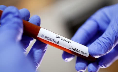 В Ужгороді  за добу виявлено 20 нових випадків коронавірусної інфекції