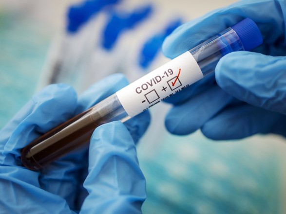 За добу в Ужгороді виявлено 106 нових випадків коронавірусної інфекції, 3 людей померли