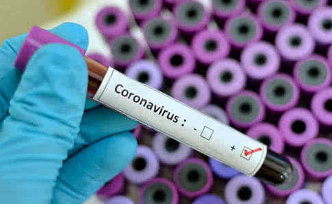 За добу в Ужгороді виявлено 54 нових випадки коронавірусної інфекції, 2 людей померло
