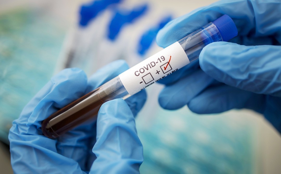 Станом на ранок 8 листопада в Ужгороді зареєстровано 38 нових випадків коронавірусної інфекції
