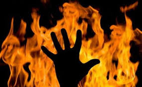 Під час пожежі у надвірній споруді на Перечинщині чоловік отримав опіки рук