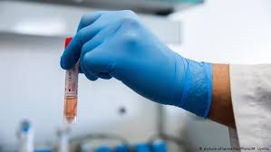 За добу в Ужгороді виявлено 94 нові випадки коронавірусної інфекції, 1 людина померла