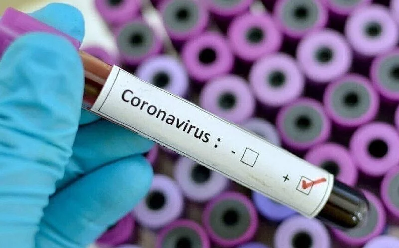 Станом на п'ятницю в Україні підтверджено 39 випадків захворювання на COVID-19