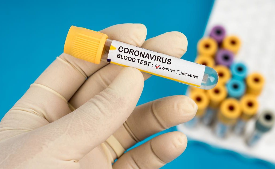 Хустська ЦРЛ забезпечена швидкими тестами на виявлення коронавірусу