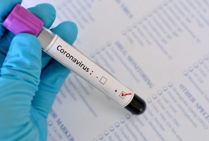 ПЛР-тестування підтвердило наявність нового коронавірусу у лікарки Іршавської ЦРЛ