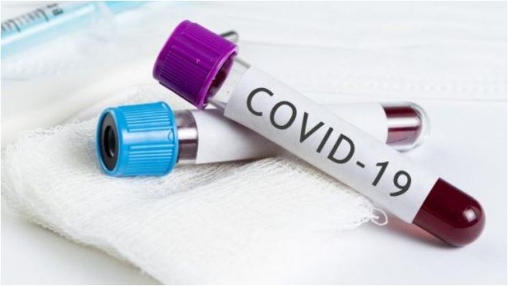 За добу на Закарпатті підтверджено 10 випадків COVID-19, з них три – у медпрацівників 