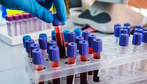 На території Баранинської ОТГ на Закарпатті підтверджено 10 випадків коронавірусу