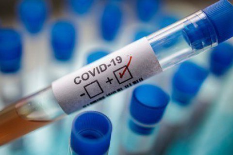 2 нових випадки коронавірусу зафіксовано в Ужгороді за добу