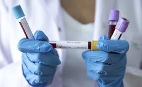В Ужгороді за добу зареєстровано 6 нових випадків захворювання на коронавірус