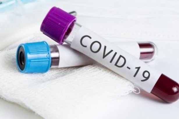 У закарпатському Чопі підтверджено 8 випадків COVID-19