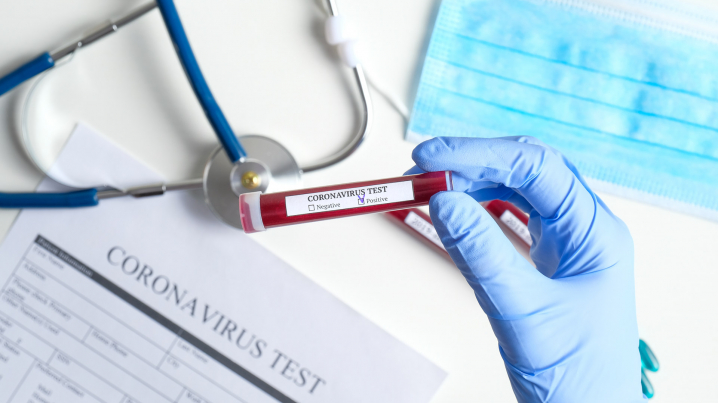 За добу в Ужгороді виявлено 12 нових випадків коронавірусної інфекції