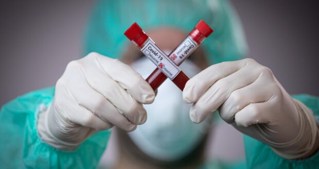Станом на ранок 4 липня в Ужгороді за добу виявили 12 нових випадків коронавірусної інфекції