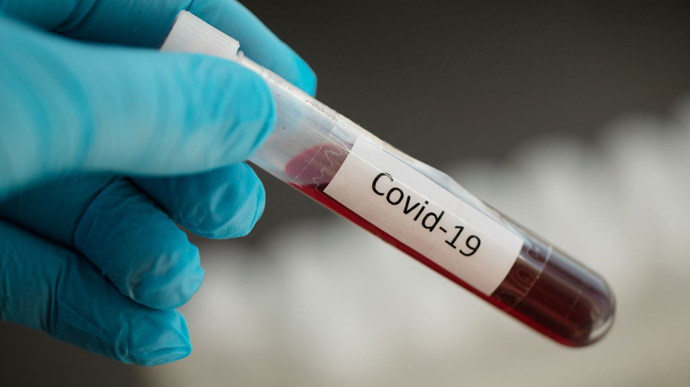 4 нових випадки COVID-19 виявлено за добу в Мукачеві