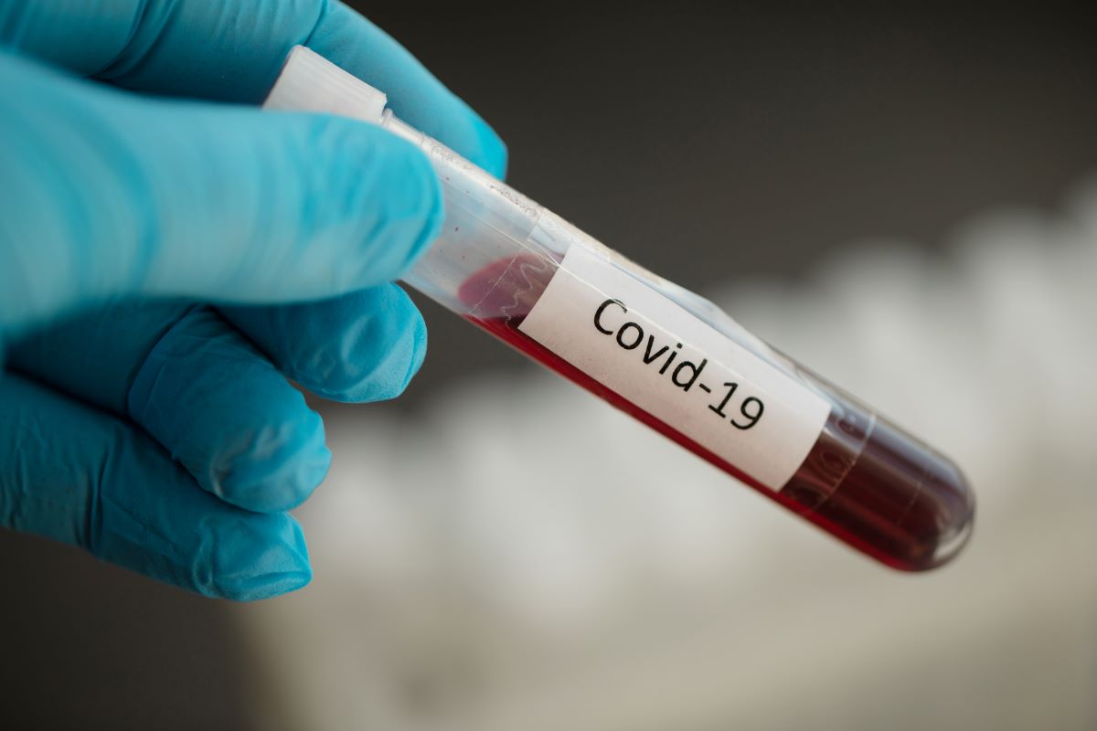 За добу в Ужгороді виявлено 11 нових випадків коронавірусної інфекції