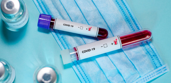 За добу в Ужгороді виявлено 9 нових випадків коронавірусної інфекції, 1 людина померла