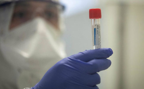 В Ужгороді за добу виявлено 10 нових випадків коронавірусної інфекції