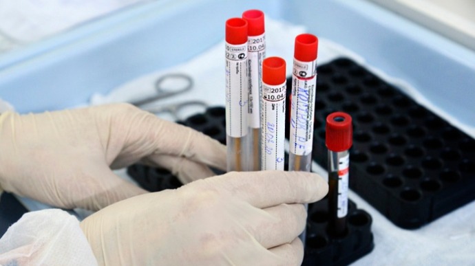 За добу в Ужгороді виявлено 6 нових випадків коронавірусної інфекції