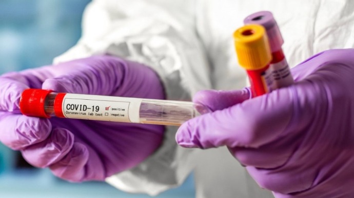 За добу в Ужгороді виявлено 25 нових випадків коронавірусної інфекції