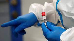 За добу в Ужгороді виявлено 20  нових випадків коронавірусної інфекції